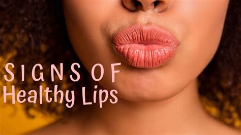 Dry Chapped Peeling Lips💋 Remedy In Minutes‼️ How To Fix Your Chapped Lips Youtube