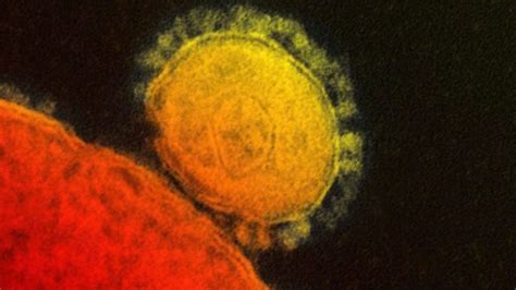 Us Confirms First Case Of Mers Coronavirus Bbc News