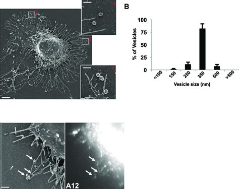 Extracellular PV Particles Are Found In Large Uniform Sized Vesicles