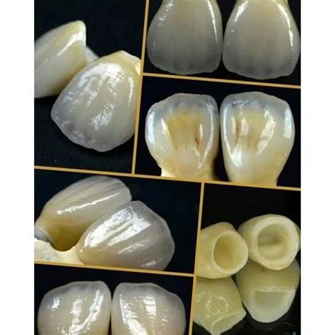 Zirconia Full Ceramic At Rs 6000 Unit Zirconia Ceramics