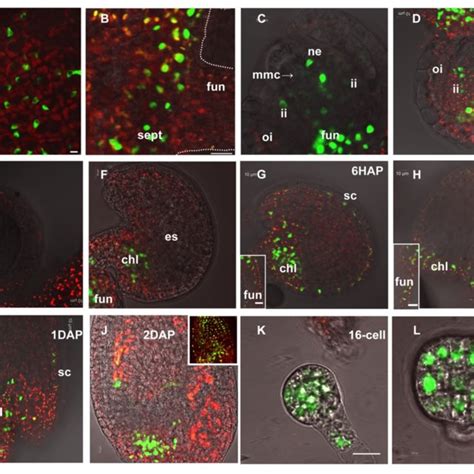 Fus3 Localization In Developing Ovules And During Early Stages Of Seed