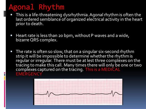 Agonal Rhythmasystole