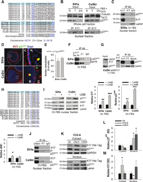 KIP1 K17 interacts with p27 in the nucleus and promotes its ... 