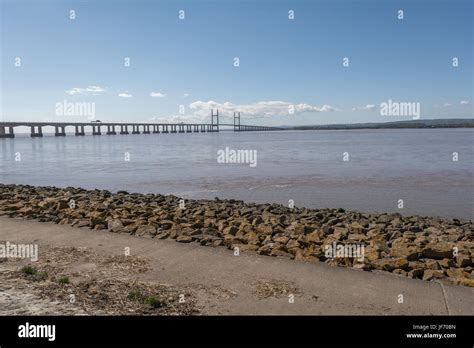 Severn Beach Hi Res Stock Photography And Images Alamy