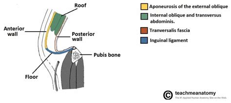 Inguinal Hernia - Classification - Management - TeachMeSurgery