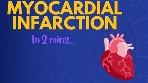 Myocardial Infarction In 2 Mins Youtube