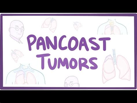 Pancoast tumors - causes, symptoms, diagnosis, treatment, pathology ...