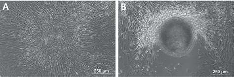 Skin Fibroblast Reprogrammed By Mrnas Codifying For Oct Sox C Myc