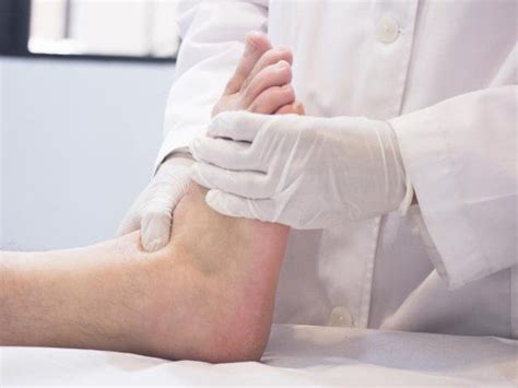 Cedera Achilles Rupture Tendon Bisakah Kembali Pulih Inafas