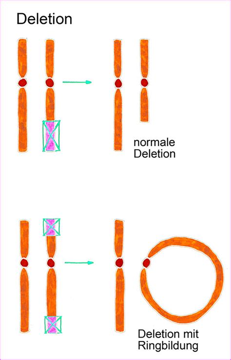 Chromosomenmutationen