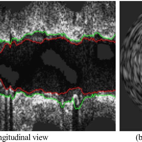 Pdf Efficient Deep Learning Assisted Annotation For Medical Image Segmentation