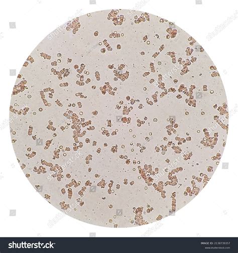 Stacks Red Blood Cells Rouleaux Formation Stock Photo 2138739357
