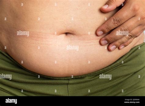 Cropped Overweight And Fat Female Belly Touching Naked Excessive