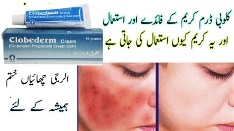 Clobederm Cream Uses In Urdu Clobetasol Benefits How To Apply