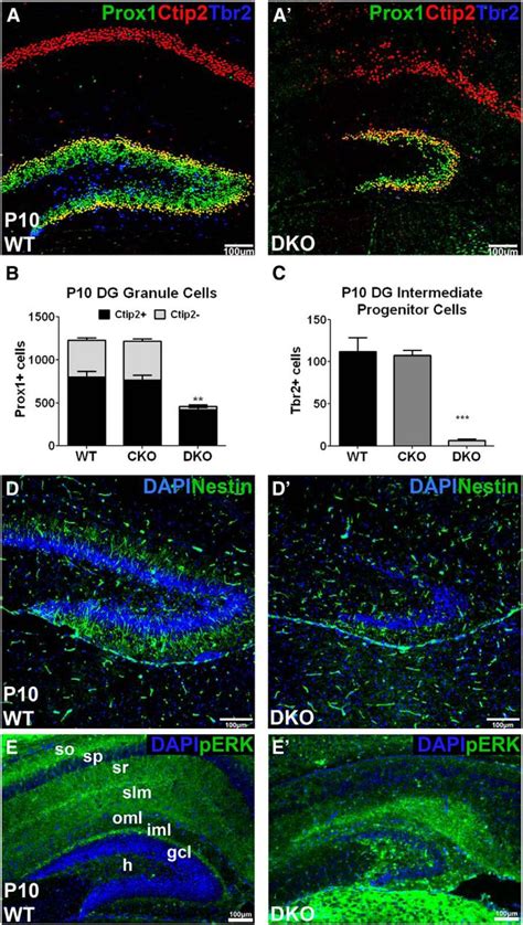 Dentate Gyrus Development Requires Erk Activity To Maintain Progenitor