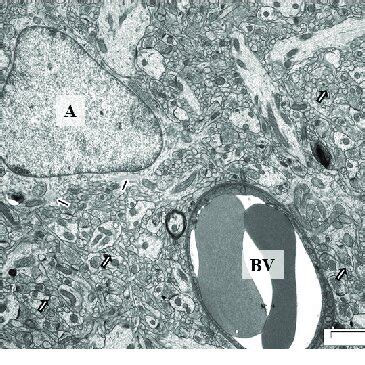 CA1 region of hippocampus from control rat (a) and and rat intoxicated ... 