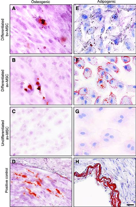 Osteogenic And Adipogenic Differentiation Potential Of Bv MSCs And