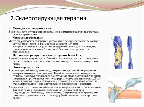Варикозное расширение вен нижних конечностей - презентация онлайн