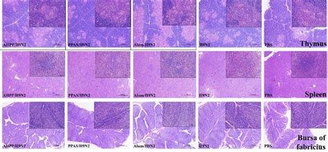 Histological Analysis Of Thymus Spleen And Bursa Of Fabricius In