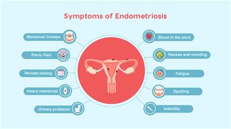 Endometriosis: Symptoms, Diagnosis, and Treatment - MatrikaIVF
