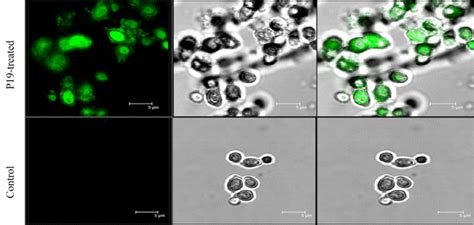 Clsm Of C Albicans 22086 Treated With Potential Peptide Or None Download Scientific Diagram