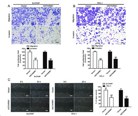 Overexpression Of Hotairm1 Suppressed Ptc Cell Migration And Invasion