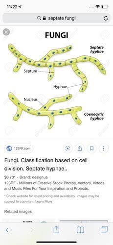 Fungi Lab Flashcards Quizlet