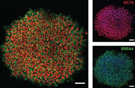 Derivation And Characterization Of IPSCs From Human MGCs A B