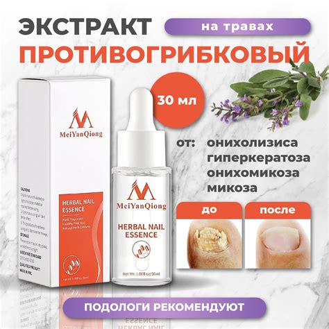 Масло для ногтей от грибка, средство для лечения грибка MeiYan , 30 мл ...