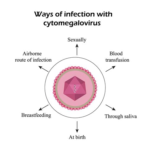 Cytomegalovirus Cmv Infection Stdgov Blog