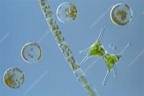 Green Alga And Diatoms Light Micrograph Stock Image C056 8437