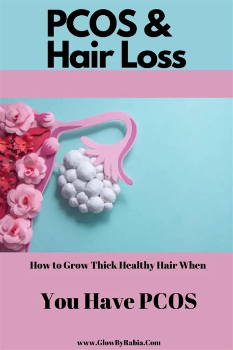 Pcos And Hair Loss What You Can Do Artofit