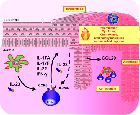 The Interleukin Il 23th17 Axis In The Immunopathogenesis Of