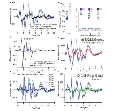 Rescue Of Hearing Function In Otof Ko Mice Auditory Brainstem Download Scientific Diagram