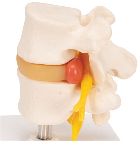 Modelo De Columna Vertebral Lumbar Medical Factory