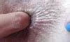 Extreme Closeup Anal Deep Fingering Asshole Amateur Porn Feat Cuteblnde Xhamster