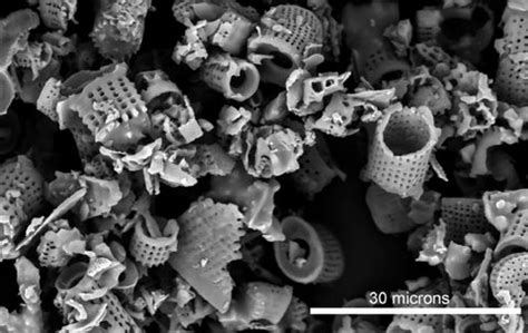 Diatoms - Nature’s Jewels viewed with a Microscope | Motic Microscopes
