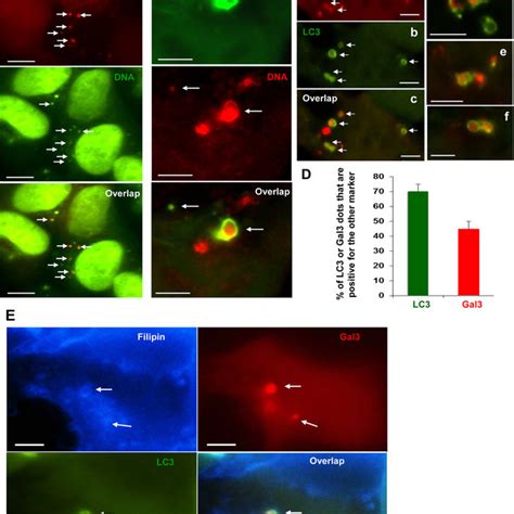 Gal Signals Are Colocalized With Rab And Lamp A And B Hek Cells