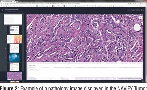 Figure 1 From A New Software Platform To Improve Multidisciplinary Tumor Board Workflows And