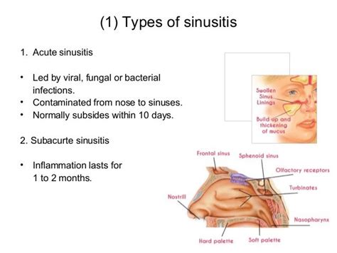 Know More Your Sinusitis Its Types And Treatment