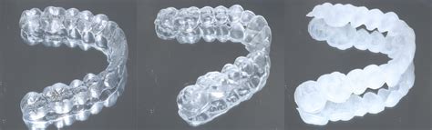 Qué diferencias existen entre el EX30 y el SmartTrack de Invisalign