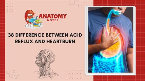 38 Difference Between Acid Reflux And Heartburn