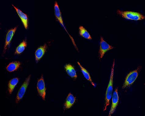 Fluorescence Live Cell Imaging | AAT Bioquest