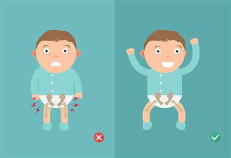 Developmental Dysplasia Of The Hip Reasons Signs And Treatment