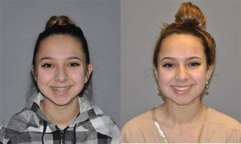 254542 Luna Plastic Surgery And Medical Spa