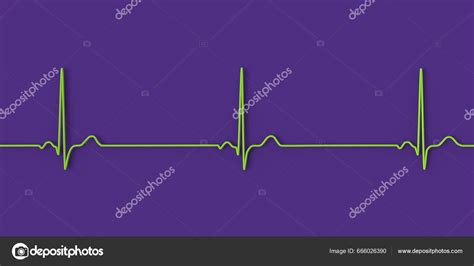 Detailed Illustration Electrocardiogram Displaying Sinus Bradycardia