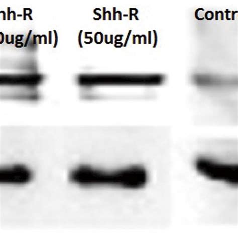 Western Blotting Analysis Of Mmp 2 Protein Expression In The Sclera Of Download Scientific