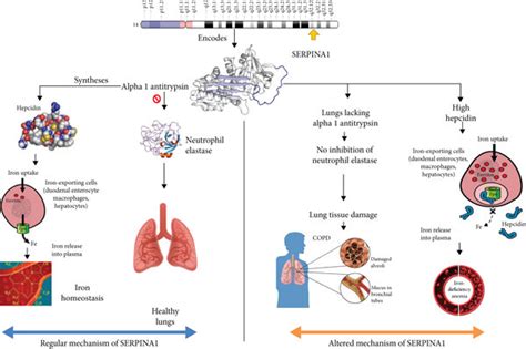 Pathophysiology Of Serpina1 Gene In Anemia And Copd Download