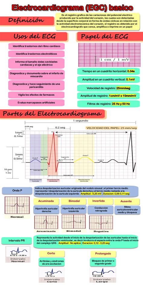 Ecg Basico Electrocardiograma B Sico Para Entender De Manera Sencilla