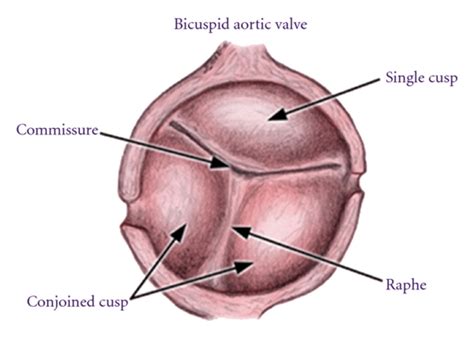 Human Heart Diagram Bicuspid Valve Valves Of The Heart What Are